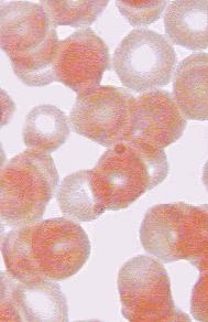 [Photograph of human red blood cells]